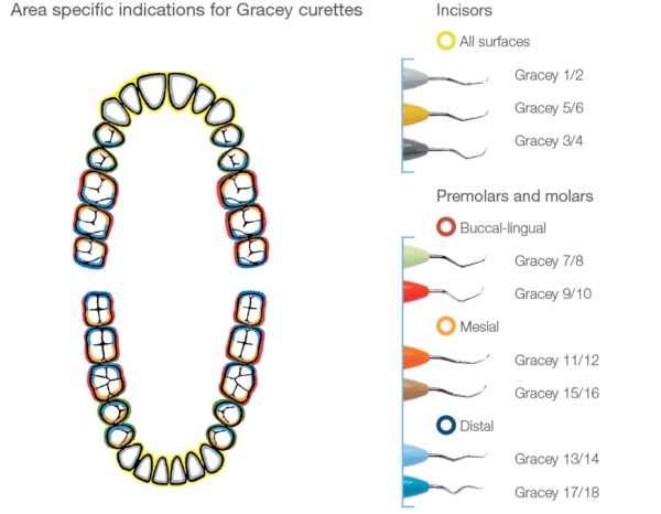 Periodontal instrument characteristics | LM-Dental